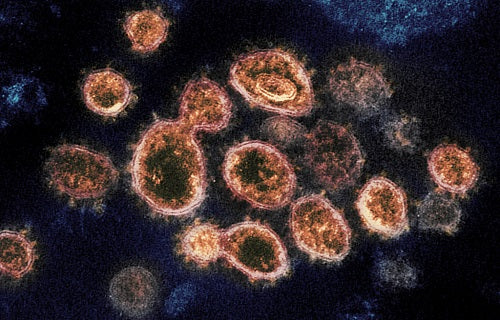 Coronavirus: All You Need To Know About Signs, Symptoms, And Risks